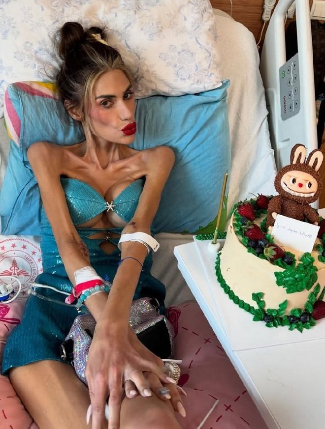 Nihal Candan Hayatını Kaybetti: Anoreksiya Nervoza Can Aldı